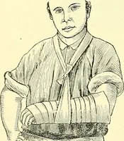 An illustration from Modern surgery, general and operative / by John Chalmers Da Costa. (1907)