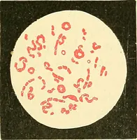 Picture 11 of 481 from Modern surgery, general and operative / by John Chalmers Da Costa. (1907), leaf 53