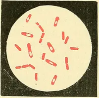Picture 12 of 481 from Modern surgery, general and operative / by John Chalmers Da Costa. (1907), leaf 53