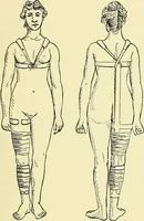 Picture 168 of 481 from Modern surgery, general and operative / by John Chalmers Da Costa. (1907), leaf 537