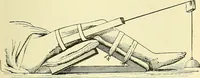 An illustration from Modern surgery, general and operative / by John Chalmers Da Costa. (1907)