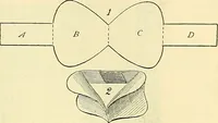 Picture 175 of 481 from Modern surgery, general and operative / by John Chalmers Da Costa. (1907), leaf 545