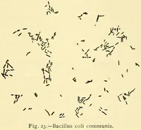 Picture 13 of 481 from Modern surgery, general and operative / by John Chalmers Da Costa. (1907), leaf 55