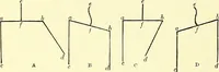 Picture 181 of 481 from Modern surgery, general and operative / by John Chalmers Da Costa. (1907), leaf 570