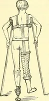 An illustration from Modern surgery, general and operative / by John Chalmers Da Costa. (1907)