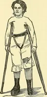 Picture 184 of 481 from Modern surgery, general and operative / by John Chalmers Da Costa. (1907), leaf 573