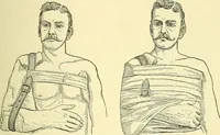 Picture 186 of 481 from Modern surgery, general and operative / by John Chalmers Da Costa. (1907), leaf 603
