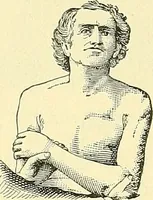 Picture 190 of 481 from Modern surgery, general and operative / by John Chalmers Da Costa. (1907), leaf 609