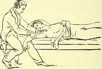 An illustration from Modern surgery, general and operative / by John Chalmers Da Costa. (1907)