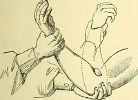 An illustration from Modern surgery, general and operative / by John Chalmers Da Costa. (1907)