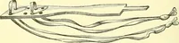 Picture 196 of 481 from Modern surgery, general and operative / by John Chalmers Da Costa. (1907), leaf 616