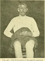 Picture 199 of 481 from Modern surgery, general and operative / by John Chalmers Da Costa. (1907), leaf 623