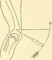 Picture 203 of 481 from Modern surgery, general and operative / by John Chalmers Da Costa. (1907), leaf 629