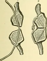 Picture 210 of 481 from Modern surgery, general and operative / by John Chalmers Da Costa. (1907), leaf 637