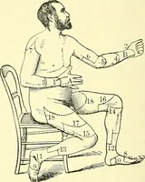 Picture 213 of 481 from Modern surgery, general and operative / by John Chalmers Da Costa. (1907), leaf 640