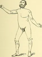 An illustration from Modern surgery, general and operative / by John Chalmers Da Costa. (1907)
