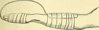 An illustration from Modern surgery, general and operative / by John Chalmers Da Costa. (1907)