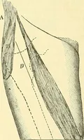 An illustration from Modern surgery, general and operative / by John Chalmers Da Costa. (1907)