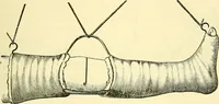 Picture 218 of 481 from Modern surgery, general and operative / by John Chalmers Da Costa. (1907), leaf 647