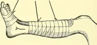 Picture 219 of 481 from Modern surgery, general and operative / by John Chalmers Da Costa. (1907), leaf 648