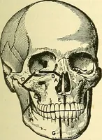 An illustration from Modern surgery, general and operative / by John Chalmers Da Costa. (1907)