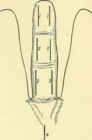Picture 223 of 481 from Modern surgery, general and operative / by John Chalmers Da Costa. (1907), leaf 667