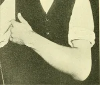 Picture 224 of 481 from Modern surgery, general and operative / by John Chalmers Da Costa. (1907), leaf 670