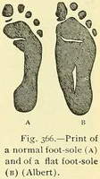 Picture 232 of 481 from Modern surgery, general and operative / by John Chalmers Da Costa. (1907), leaf 681