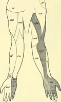 An illustration from Modern surgery, general and operative / by John Chalmers Da Costa. (1907)