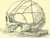 An illustration from Modern surgery, general and operative / by John Chalmers Da Costa. (1907)