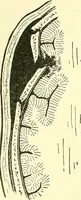 An illustration from Modern surgery, general and operative / by John Chalmers Da Costa. (1907)