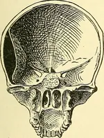 An illustration from Modern surgery, general and operative / by John Chalmers Da Costa. (1907)