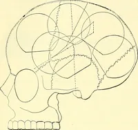 Picture 261 of 481 from Modern surgery, general and operative / by John Chalmers Da Costa. (1907), leaf 754