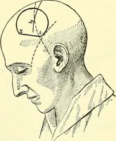 Picture 262 of 481 from Modern surgery, general and operative / by John Chalmers Da Costa. (1907), leaf 754