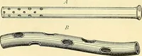 Picture 29 of 481 from Modern surgery, general and operative / by John Chalmers Da Costa. (1907), leaf 77