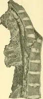Picture 266 of 481 from Modern surgery, general and operative / by John Chalmers Da Costa. (1907), leaf 775