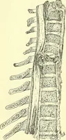 Picture 267 of 481 from Modern surgery, general and operative / by John Chalmers Da Costa. (1907), leaf 776