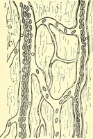 Picture 33 of 481 from Modern surgery, general and operative / by John Chalmers Da Costa. (1907), leaf 80