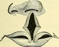Picture 272 of 481 from Modern surgery, general and operative / by John Chalmers Da Costa. (1907), leaf 809