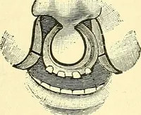 Picture 273 of 481 from Modern surgery, general and operative / by John Chalmers Da Costa. (1907), leaf 809