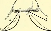 Picture 274 of 481 from Modern surgery, general and operative / by John Chalmers Da Costa. (1907), leaf 810