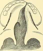Picture 277 of 481 from Modern surgery, general and operative / by John Chalmers Da Costa. (1907), leaf 811