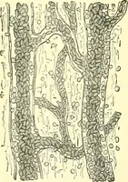Picture 35 of 481 from Modern surgery, general and operative / by John Chalmers Da Costa. (1907), leaf 82