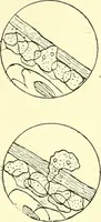 Picture 36 of 481 from Modern surgery, general and operative / by John Chalmers Da Costa. (1907), leaf 84