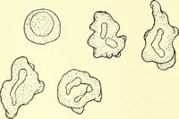 Picture 39 of 481 from Modern surgery, general and operative / by John Chalmers Da Costa. (1907), leaf 84