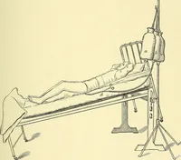 An illustration from Modern surgery, general and operative / by John Chalmers Da Costa. (1907)