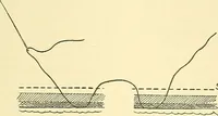 An illustration from Modern surgery, general and operative / by John Chalmers Da Costa. (1907)