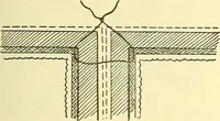 Picture 293 of 481 from Modern surgery, general and operative / by John Chalmers Da Costa. (1907), leaf 945
