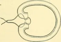 An illustration from Modern surgery, general and operative / by John Chalmers Da Costa. (1907)