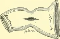 Picture 295 of 481 from Modern surgery, general and operative / by John Chalmers Da Costa. (1907), leaf 946